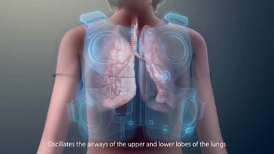 CGI video models The Monarch® System, points out PODs and adjustable strap positions, depicts how operation thins/clears airway mucus.