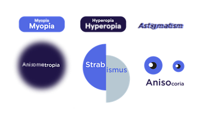 Six amblyopic risk factors–myopia, hyperopia, astigmatism, anisometropia, strabismus and anisocoria