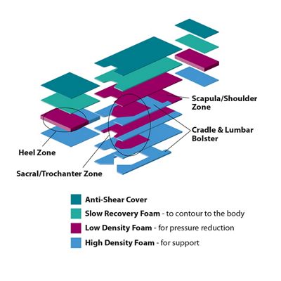 Alto Surface Pad Layers