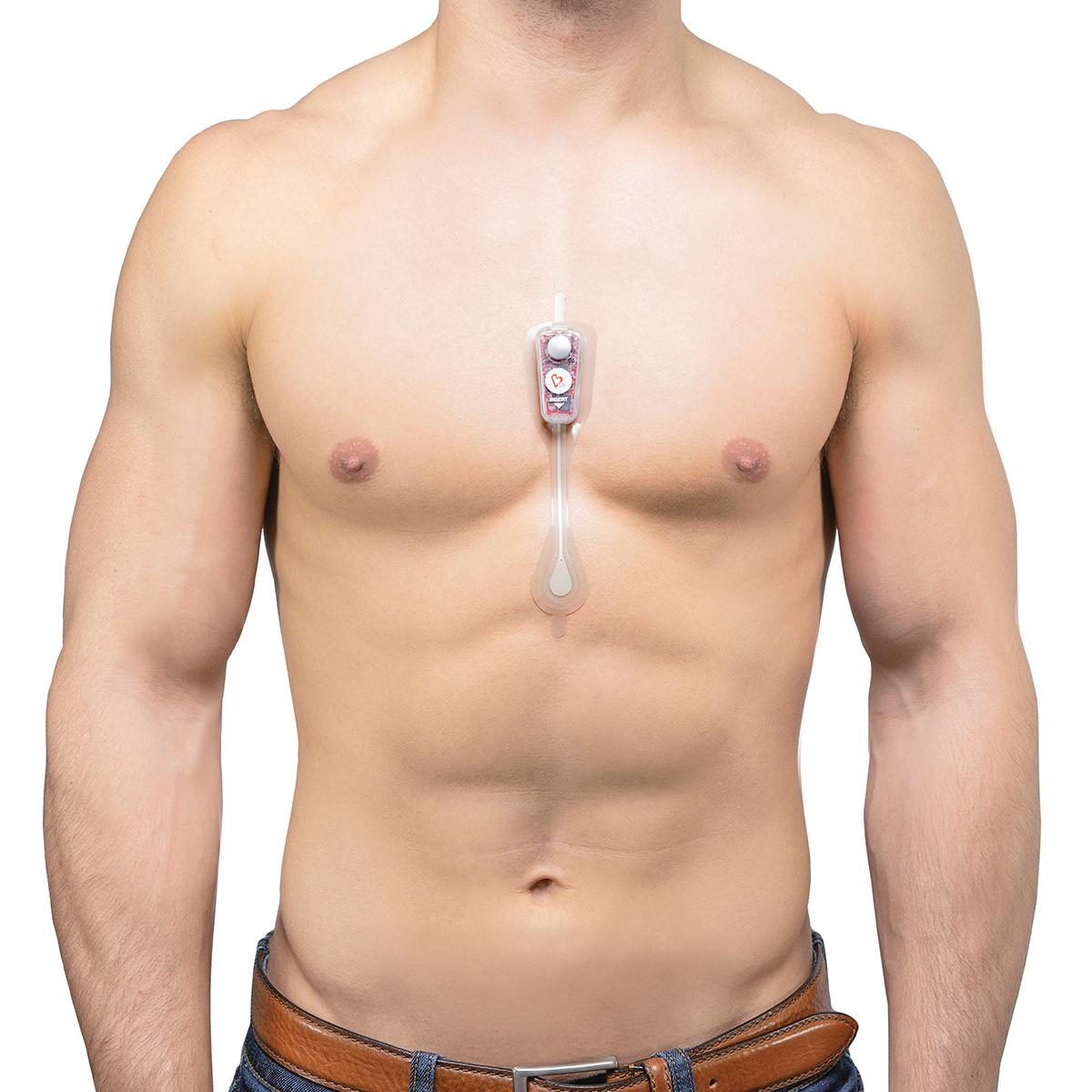 patient with device on chest