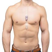 patient with device on chest