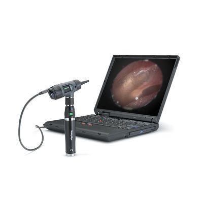 Otoscope MacroView numérique