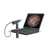 Digital MacroView Otoscope, 3/4 view, connected to laptop displaying a large view of the inner ear