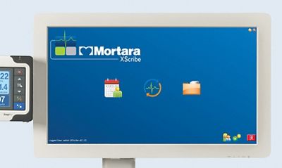 Das Xscribe System verfügt über ein großes Display und ein übersichtliches Layout zur Vereinfachung der Untersuchungen.