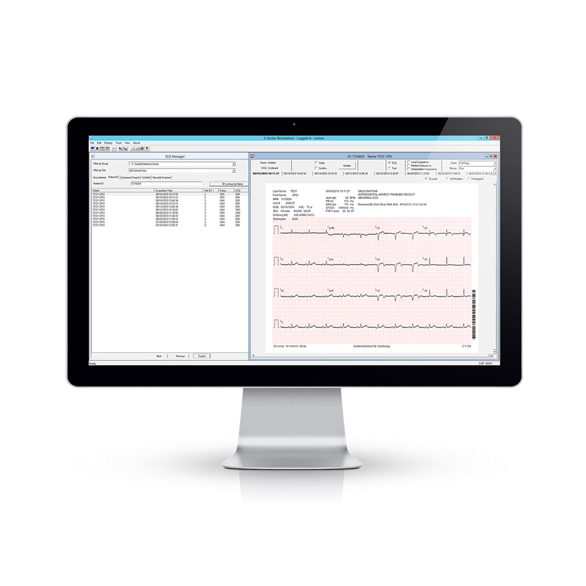 E-Scribe Holter Analysis System on monitor