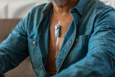 bardy cam patch on patient chest