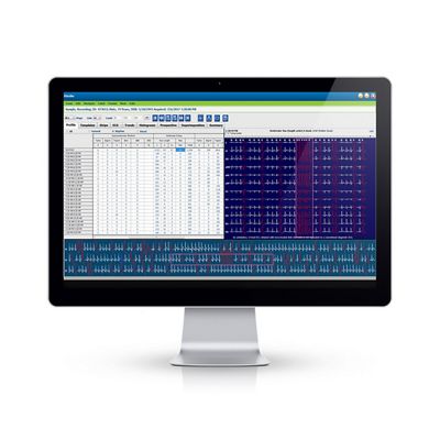 Computer screen with Hscribe Holter Analysis System