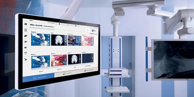 Image of a video screen in the OR.