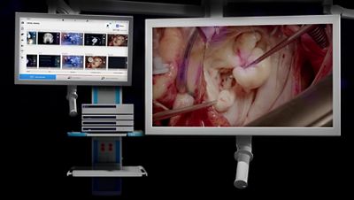 Helion OR Integration System