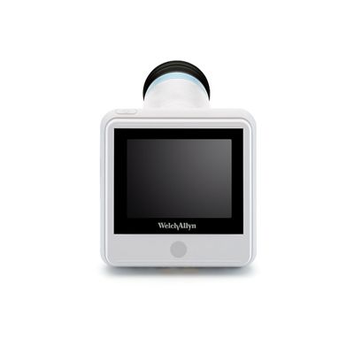 RetinaVue 100 Imager, straight on view