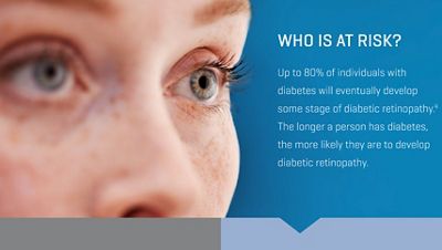 monica johnson's side profile