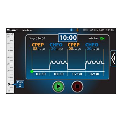 Een close up van het goed afleesbare digitale scherm van het Volara-systeem, waarop piekdruk, CHFO-frequentie, polsfrequentie en O2-waarden worden weergegeven.