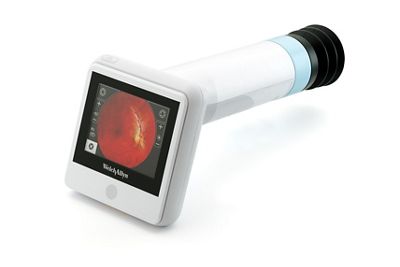 RetinaVue 100 imager pro without cradle