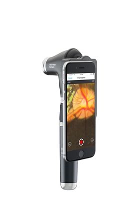 PanOptic Plus ophthalmoscope view of a canine's eye on an iphone through the iExaminer Pro System