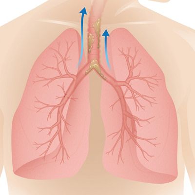 lungs