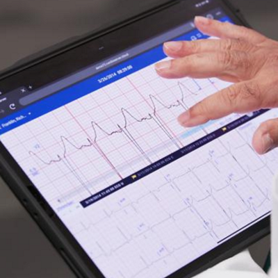 cardiology ecg report on tablet