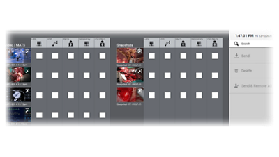 Helion OR Integration Media Capture/Edit/Export