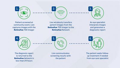 retinavue-syracuse-lions-testimonial-workflow