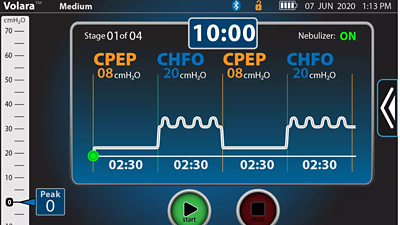 volara stage on monitor screen